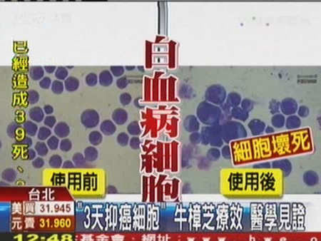 牛樟芝 白血病
