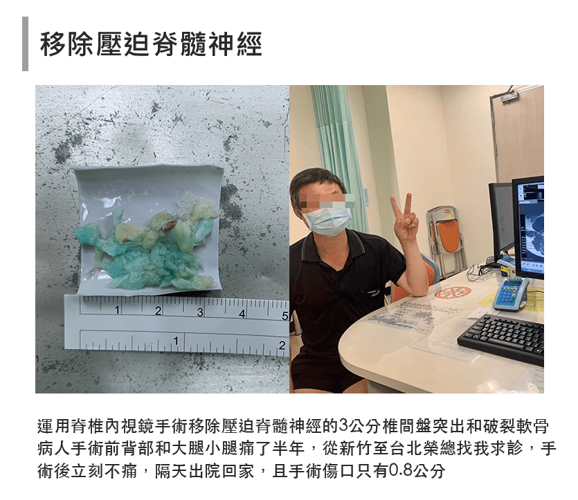 張軒侃醫師 脊椎側彎微創手術